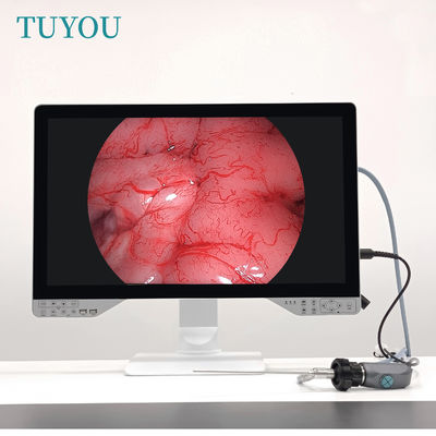 Αγορά TUYOU 27inches 1080P Full HD All In One ιατρική ενδοσκόπηση κάμερα για αρθροσκόπηση σε απευθείας σύνδεση κατασκευή