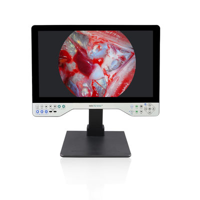 Αγορά Φαρμακευτικό σύστημα κάμερας FHD Endoscope με λειτουργία αναπαραγωγής και αποθήκευσης USB σε απευθείας σύνδεση κατασκευή