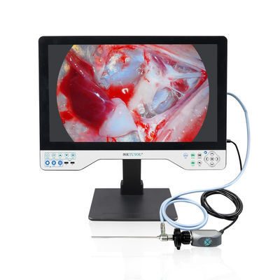Αγορά 24in Endoscopy LED Light Source Endoscope Camera Recorder για χειρουργικές επεμβάσεις υψηλής ευκρίνειας Laparoscopy Cystoscope σε απευθείας σύνδεση κατασκευή