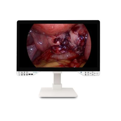 Αγορά 27 ιντσών FHD 1080P Endoscopic Camera System Μόνο άκαμπτο ενδοσκόπιο με οθόνη και 100W αποτελεσματική οπτική ισχύ σε απευθείας σύνδεση κατασκευή