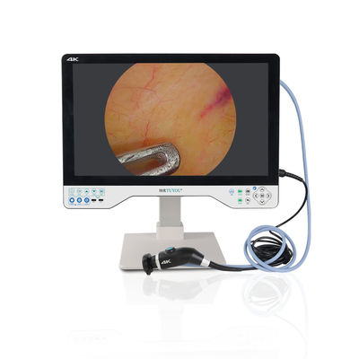 Αγορά Τούιο 24 ιντσών 1080P Endoscope κάμερα με IPX8 Αδιάβροχο 8 ώρες διάρκεια ζωής της μπαταρίας και 2 χρόνια εγγύηση για ιατρική ενδοσκόπηση σε απευθείας σύνδεση κατασκευή