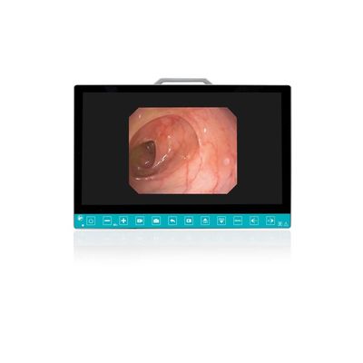Αγορά TUYOU 13.3-Inch FHD Flexible Endoscope Camera System Multi-Color OEM Custom All-in-One Portable Uro-Gyn TikTok Hit σε απευθείας σύνδεση κατασκευή