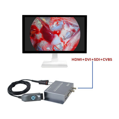 Αγορά TUYOU Manufacturer4-Output FHD Portable  Endoscopy Camera System  For ENT Checking σε απευθείας σύνδεση κατασκευή