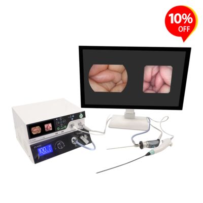 Αγορά TUYOU HD Endoscopy Camera System with ENT Bronchoscopy Checking and Laparoscopy Urology Applications Featuring Auto White Balance σε απευθείας σύνδεση κατασκευή