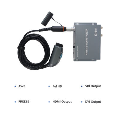 Αγορά Wireless Portable Endoscope Camera System - High Resolution for ENT/Orthopedics Clinical Examination σε απευθείας σύνδεση κατασκευή