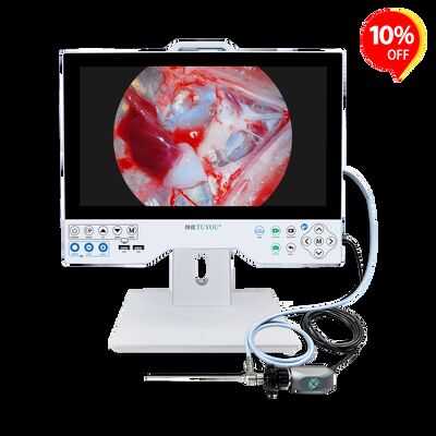 Αγορά Economical Full HD All-in-One Endoscope Camera System - CE Certified Integrated Monitor for Laparoscopy/Gynecology Exams σε απευθείας σύνδεση κατασκευή
