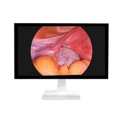 TUYOU 4K 32' Ιατρικό σύστημα κάμερας ενδοσκόπησης όλα σε ένα με LED πηγή φωτός για ΕΛΤ λαπαροσκόπηση