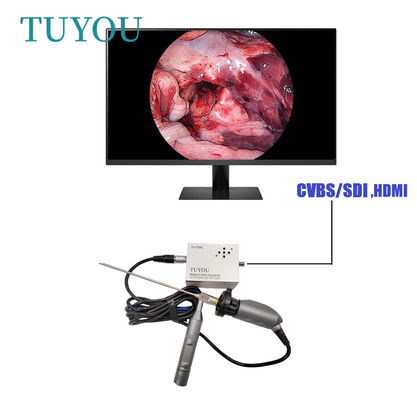 Full HD Ηλεκτρική Φορητή Ενδοσκοπική Ιατρική Κάμερα για Λάπτοπ