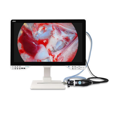 Σύστημα Ενδοσκοπικής Κάμερας 4K All In One TUYOU Medical με Πηγή Φωτός και Οθόνη για Λαπαροσκοπική Χειρουργική