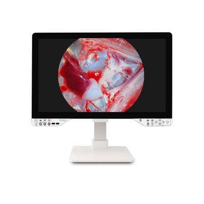 27 ιντσών ιατρική ενδοσκόπηση Full HD για γυναικολογική χειρουργική με φωτεινή πηγή και οθόνη
