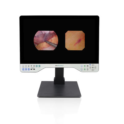 1080P Full HD Endoscope System Σκληρή και ευέλικτη 24 ιντσών βιντεοκάμερα
