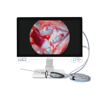 4K All In One Endoscope Camera System Ενσωματωμένο φως LED με ιατρική οθόνη 32 ιντσών