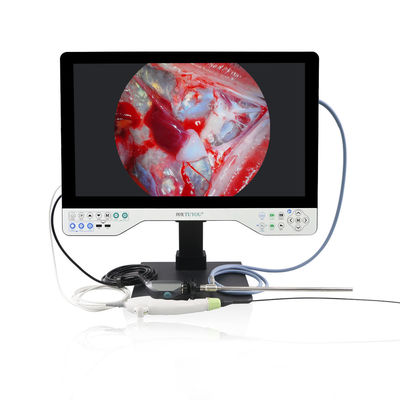 Σύστημα κάμερας 4K All In One Endoscope Ενσωματωμένο φως LED & ευέλικτη εμβέλεια για λαπαροσκόπηση
