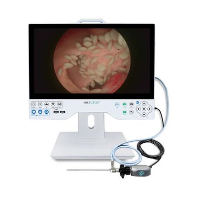 Ζεστή πώληση 15.6 ιντσών Full HD Ενσωματωμένη ενδοσκοπική κάμερα και σύστημα οθόνης για χειρουργείο λαπαροσκοπίας