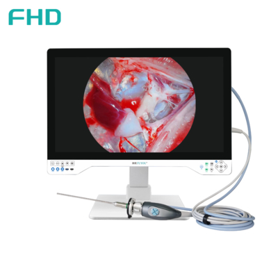 4K All In One Endoscope Camera System Ενσωματωμένο φως LED με ιατρική οθόνη 32 ιντσών