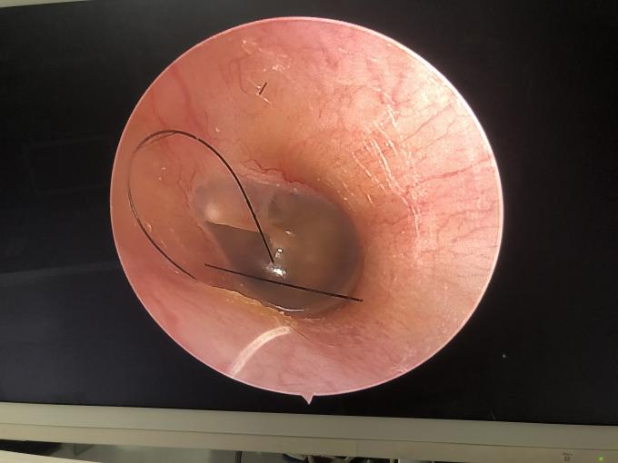 Φορητή οθόνη LCD All In One HD Ενδοσκοπική κάμερα για ΟΡΤ Λαπαροσκοπία Υστεροσκοπία Ουρολογία 2