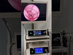 Σύστημα κάμερας λειτουργίας καταγραφής βίντεο 4K