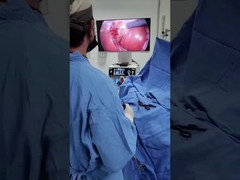 Σύστημα κάμερας TU-LSD90TB 2 σε 1 με κρύα φωτεινή πηγή για Λαπαροσκοπία και ΟΡΤ