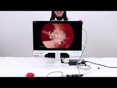 24in TUYOU Νασοφαρυγκοσκόπιο Ενδοσκόπιο Καταγραφέας Καμερας Για Λαπαροσκοπία υψηλής ευκρίνειας